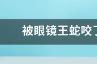 缅甸蟒天敌？ 被眼镜王蛇咬了有救吗