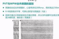 室性早搏，应长期服普罗帕酮还是胺碘酮？ 普罗帕酮和胺碘酮区别