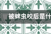 被蜱虫咬后是什么样子有图最好 蜱虫咬了是什么样子图