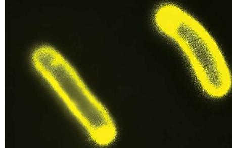 研究不足的蛋白质团块对细胞生物化学有整体影响